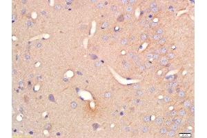 Formalin-fixed and paraffin embedded rat brain labeled with Anti-Serine Racemase Polyclonal Antibody, Unconjugated  at 1:200 followed by conjugation to the secondary antibody and DAB staining (SRR Antikörper  (AA 1-100))