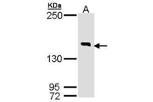 WB Image Sample (30 ug of whole cell lysate) A: Hela 7. (DIP2B Antikörper  (C-Term))