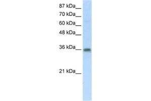 Western Blotting (WB) image for anti-Transformer 2 beta Homolog (TRA2B) antibody (ABIN2462167) (TRA2B Antikörper)