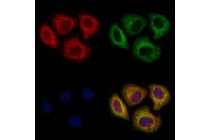 ABIN6265879 and ABIN6278541 staining Hela cells by IF/ICC. (UGT8 Antikörper  (Internal Region))