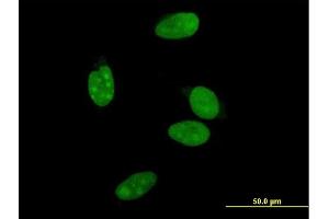 Immunofluorescence of monoclonal antibody to NR0B2 on HeLa cell. (NR0B2 Antikörper  (AA 1-257))
