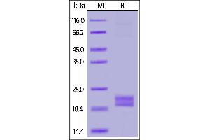 Biotinylated Human PD-L1 (19-134), His,Avitag on  under reducing (R) condition. (PD-L1 Protein (AA 19-134) (His tag,AVI tag,Biotin))