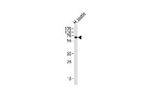 Western blot analysis of lysate from human testis tissue lysate, using ZIM2 Antibody (N-term) (ABIN6244190 and ABIN6577604). (ZIM2 Antikörper  (N-Term))