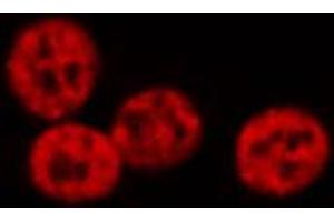 ABIN6274223 staining Hela cells by IF/ICC. (GTF2E2 Antikörper  (Internal Region))