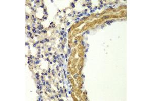 Immunohistochemistry (IHC) image for anti-Protein Kinase, CGMP-Dependent, Type I (PRKG1) (AA 1-300) antibody (ABIN3016256) (PRKG1 Antikörper  (AA 1-300))