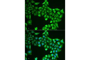 Immunofluorescence analysis of HeLa cells using ASL antibody (ABIN5973767). (ASL Antikörper)