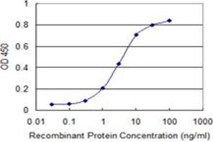 Detection limit for recombinant GST tagged UPF1 is 0. (RENT1/UPF1 Antikörper  (AA 1019-1116))