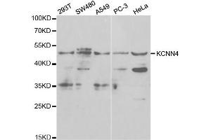 Western Blotting (WB) image for anti-Potassium Intermediate/small Conductance Calcium-Activated Channel, Subfamily N, Member 4 (KCNN4) antibody (ABIN1873386) (KCNN4 Antikörper)