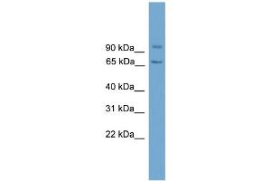 WB Suggested Anti-LOH11CR2A Antibody Titration: 0. (VWA5A Antikörper  (N-Term))