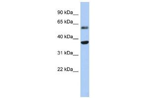 WB Suggested Anti-RDH10 Antibody Titration: 0.