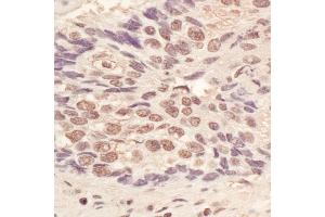 anti-L(3)mbt-Like 3 (L3MBTL3) (AA 550-600) antibody