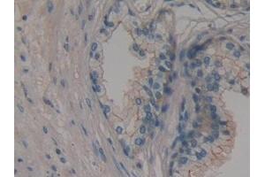 Immunohistochemistry (IHC) image for anti-Membrane Protein, Palmitoylated 6 (MAGUK P55 Subfamily Member 6) (MPP6) (AA 331-503) antibody (ABIN7432430)