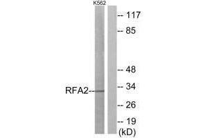 Western blot analysis of extracts from K562 cells, using RFA2 (Ab-21) antibody. (RPA2 Antikörper  (Thr21))
