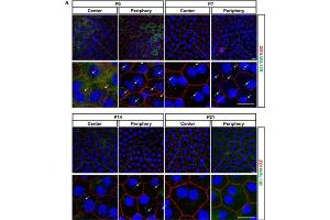 Confocal images stained for Arl13b (cat. (ARL13B Antikörper  (C-Term))