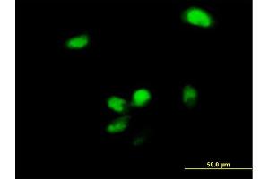 Immunofluorescence of purified MaxPab antibody to YBX2 on HeLa cell. (YBX2 Antikörper  (AA 1-364))