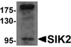 Western blot analysis of SIK2 in SW480 cell lysate with SIK2 antibody at 1 μg/ml. (SIK2 Antikörper  (Center))