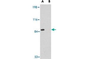 Western blot analysis of RIMS2 in rat brain tissue lysate with RIMS2 polyclonal antibody  at 1 ug/mL in the (A) absence or (B) presence of blocking peptide. (RIMS2 Antikörper  (Internal Region))