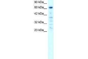 WB Suggested Anti-PAntibody Titration:  0. (PARP3 Antikörper  (C-Term))