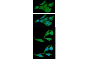 ICC/IF analysis of CRADD in HeLa cells line, stained with DAPI (Blue) for nucleus staining and monoclonal anti-human CRADD antibody (1:100) with goat anti-mouse IgG-Alexa fluor 488 conjugate (Green). (CRADD Antikörper)