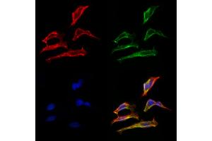 ABIN6263296 and ABIN6266592 staining Hela cells by IF/ICC.