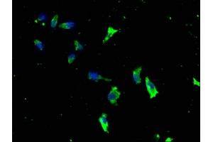 Immunofluorescence staining of SH-SY5Y cells with ABIN7157554 at 1:133, counter-stained with DAPI. (KSR1 Antikörper  (AA 404-598))