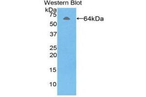 Western Blotting (WB) image for anti-alpha-Fetoprotein (AFP) (AA 31-576) antibody (ABIN1857934) (alpha Fetoprotein Antikörper  (AA 31-576))