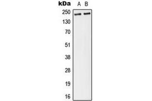 Western blot analysis of Separase (pS801) expression in MDA-MB-231 (A), A431 (B) whole cell lysates.