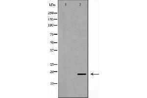 Western blot analysis of Hela whole cell lysates, using UBE2C Antibody. (UBE2C Antikörper  (C-Term))
