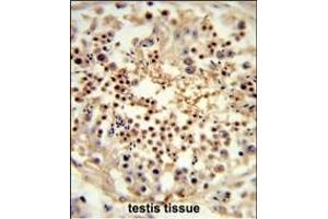 Formalin-fixed and paraffin-embedded human testis tissue reacted with UN Antibody (Center) (ABIN653320 and ABIN2842812) , which was peroxidase-conjugated to the secondary antibody, followed by DAB staining. (UNC119 Antikörper  (AA 64-94))