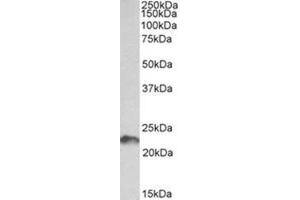 Western Blotting (WB) image for anti-Leukemia Inhibitory Factor (LIF) (AA 28-39), (Internal Region) antibody (ABIN1449476) (LIF Antikörper  (Internal Region))