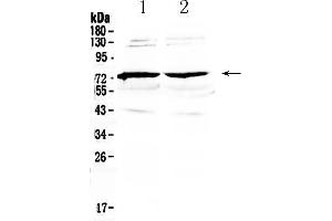 Western blot analysis of GAS 6 using anti-GAS 6 antibody .