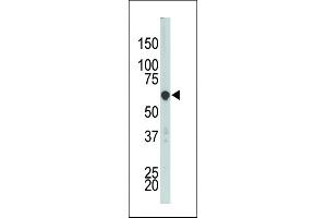 The anti-PCTK3 Pab (ABIN391790 and ABIN2841646) is used in Western blot to detect PCTK3 in HL-60 cell lysate. (CDK18 Antikörper  (N-Term))