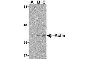 Western Blotting (WB) image for anti-Actin, beta (ACTB) (N-Term) antibody (ABIN2477265) (beta Actin Antikörper  (N-Term))