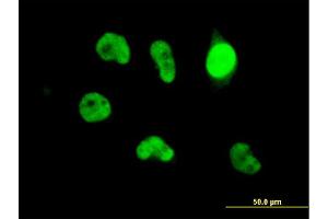 Immunofluorescence of monoclonal antibody to ZBED1 on HeLa cell.