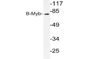 Western blot analysis of B-Myb antibody in extracts from K562 cells. (MYBL2 Antikörper)