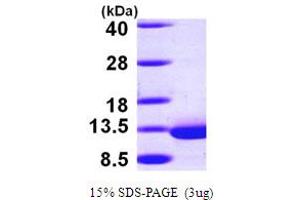 SDS-PAGE (SDS) image for Dynein, Light Chain, Roadblock Type 1 (DYNLRB1) (AA 1-96) protein (His tag) (ABIN667168)