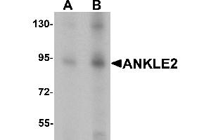 Western blot analysis of ANKLE2 in SW480 cell lysate with ANKLE2 antibody at (A) 1 and (B) 2 µg/mL.