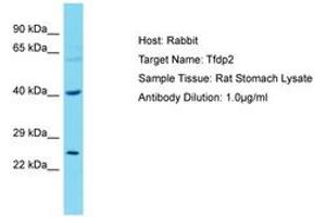 Image no. 1 for anti-Transcription Factor Dp-2 (E2F Dimerization Partner 2) (TFDP2) (AA 51-100) antibody (ABIN6750289) (DP2 Antikörper  (AA 51-100))