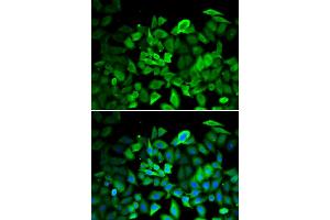 Immunofluorescence analysis of HeLa cells using ANXA1 antibody. (Annexin a1 Antikörper)