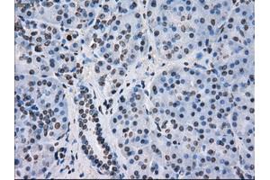 Immunohistochemical staining of paraffin-embedded colon tissue using anti-FKBP5mouse monoclonal antibody. (FKBP5 Antikörper)