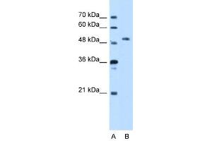 WB Suggested Anti-STK39 Antibody Titration:  5. (STK39 Antikörper  (N-Term))
