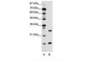 Image no. 1 for anti-CCAAT/enhancer Binding Protein (C/EBP), gamma (CEBPG) (AA 11-60) antibody (ABIN6736115) (CEBPG Antikörper  (AA 11-60))