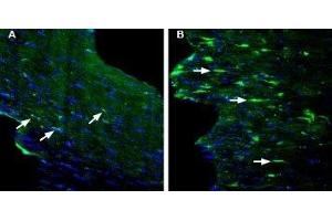 Expression of GPR84 in mouse fornix in a kainic acid-induced model of temporal lobe epilepsy - Immunohistochemical staining of perfusion-fixed frozen mouse brain sections with Anti-GPR84 (extracellular) Antibody (ABIN7043175, ABIN7044443 and ABIN7044444), (1:200), followed by goat anti-rabbit-AlexaFluor-488. (GPR84 Antikörper  (Extracellular))