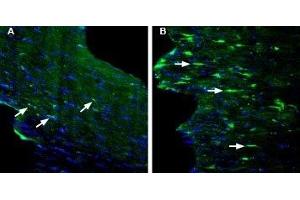 Expression of GPR84 in mouse fornix in a kainic acid-induced model of temporal lobe epilepsy - Immunohistochemical staining of perfusion-fixed frozen mouse brain sections with Anti-GPR84 (extracellular) Antibody (ABIN7043175, ABIN7044443 and ABIN7044444), (1:200), followed by goat anti-rabbit-AlexaFluor-488. (GPR84 Antikörper  (2nd Extracellular Loop))