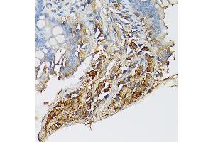 Immunohistochemistry of paraffin-embedded mouse intestin using CD117/c-Kit antibody (ABIN6133454, ABIN6142896, ABIN6142898 and ABIN6213818) at dilution of 1:150 (40x lens).