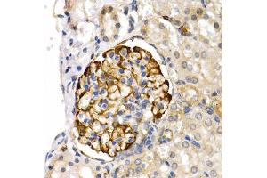 Immunohistochemistry of paraffin-embedded rat kidney using LIPG antibody (ABIN5975340) at dilution of 1/200 (40x lens). (LIPG Antikörper)
