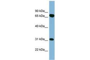 Image no. 1 for anti-HIRA Interacting Protein 3 (HIRIP3) (AA 395-444) antibody (ABIN6742134) (HIRIP3 Antikörper  (AA 395-444))