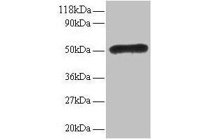 Western blot All lanes: LMO1 antibody at 2 μg/mL Lane 1: EC109 whole cell lysate Lane 2: 293T whole cell lysate Secondary Goat polyclonal to rabbit IgG at 1/15000 dilution Predicted band size: 18 kDa Observed band size: 50 kDa (LMO1 Antikörper  (AA 5-156))