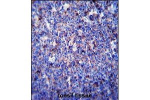 Immunohistochemistry (Paraffin-embedded Sections) (IHC (p)) image for anti-Matrix Metallopeptidase 3 (Stromelysin 1, Progelatinase) (MMP3) (AA 30-59), (N-Term) antibody (ABIN657459)