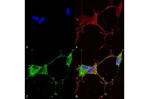 Immunocytochemistry/Immunofluorescence analysis using Mouse Anti-GABA-B Receptor 2 Monoclonal Antibody, Clone S81-2 (ABIN2484088). (GABBR2 Antikörper  (AA 861-912) (PE))